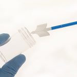 Δωρεάν test pap για όλες τις εργαζόμενες στον Δήμο Χαλανδρίου